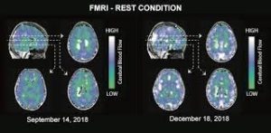 The Foundation by neuroflux (Revitalize your brain in as little as 4 x 20-30 minute sessions per week)